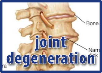 Physiotherapy: Muscle Strengthening in Degenerative Joints and Spine Conditions By Mr Subramaniam Ganesh Sundaram