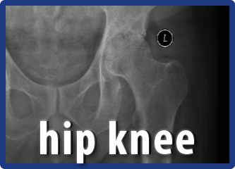 Role Of Primary Care In Managing Hip & Knee Osteoarthritis By Prof. Azlina Amir Abbas