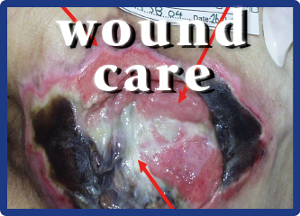 Wound Assessment By Prof. Dr Harikrishna K. R. Nair