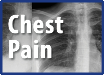 Approach To Chest Pain By Dr Seri Rohayu Bt Noew Hanzah